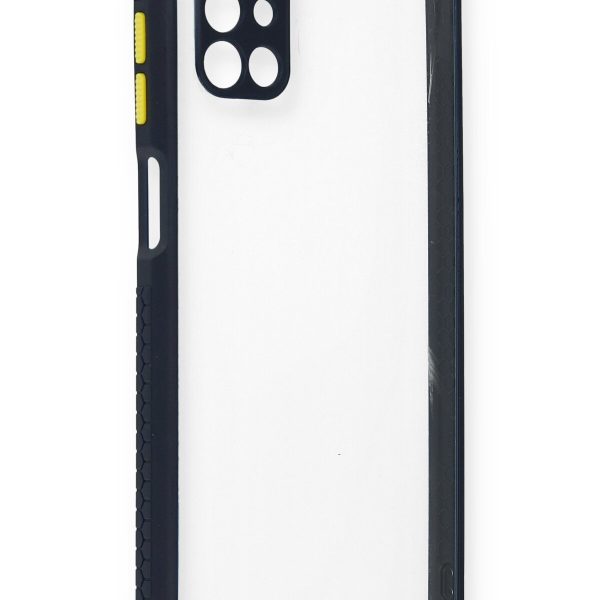 Newface Samsung Galaxy M51 Kılıf Miami Şeffaf Silikon  - Lacivert