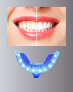 LED Işıklı Profesyonel Diş Beyazlatma Seti - Görsel 2
