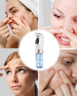 Elektrikli Siyah Nokta Cihazı - Görsel 3