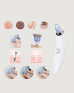 USB Destekli 4 Başlıklı Siyah Nokta Vakum Cihazı – Gözenek Temizleyici ve Cilt Yenileyici Bakım Aleti - Görsel 4