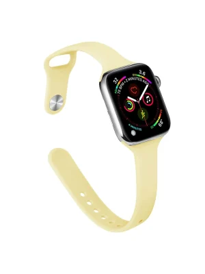 Newface Apple Watch 38mm Klasik Kordon - Sarı