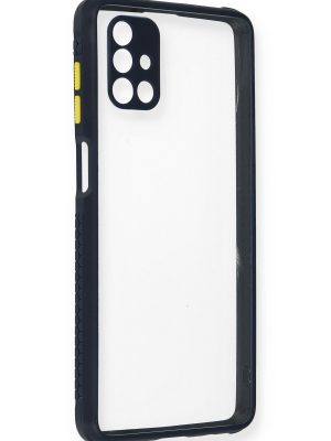 Newface Samsung Galaxy M51 Kılıf Miami Şeffaf Silikon  - Lacivert