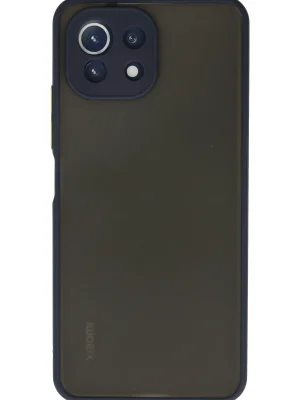 Newface Xiaomi Mİ 11 Lite Kılıf Montreal Silikon Kapak - Lacivert