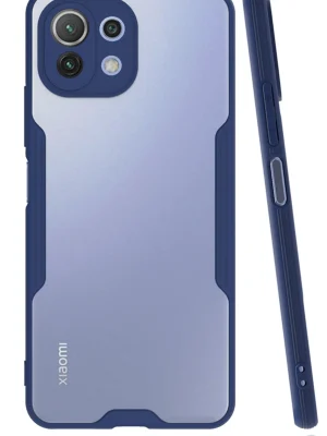 Newface Xiaomi Mİ 11 Lite Kılıf Platin Silikon - Lacivert