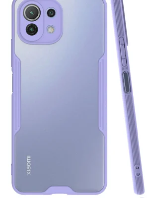 Newface Xiaomi Mİ 11 Lite Kılıf Platin Silikon - Lila