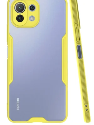 Newface Xiaomi Mİ 11 Lite Kılıf Platin Silikon - Sarı