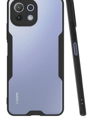 Newface Xiaomi Mİ 11 Lite Kılıf Platin Silikon - Siyah