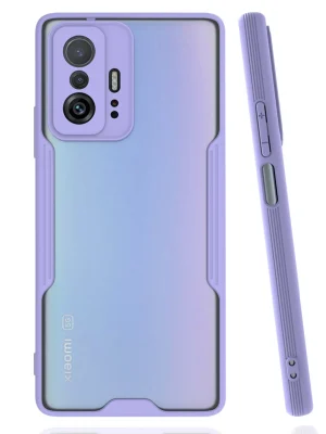 Newface Xiaomi Mi 11T Pro Kılıf Platin Silikon - Lila