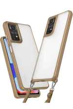 Newface Xiaomi Redmi Note 11 Pro Kılıf Penta Silikon Kılıf - Çöl Titanyum