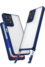 Newface Xiaomi Redmi Note 11 Pro Kılıf Penta Silikon Kılıf - Lacivert