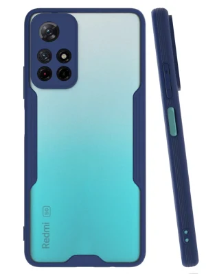 Newface Xiaomi Redmi Note 11T Kılıf Platin Silikon - Lacivert