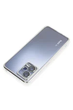 Newface Xiaomi Redmi Note 12 5G Kılıf Razer Lensli Silikon - Gold - Görsel 5