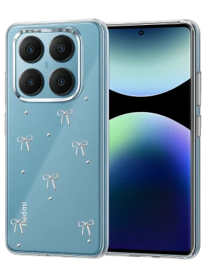 Newface Xiaomi Redmi Note 14 Pro 4G Fiyonk Desenli Kapak - Desen 1