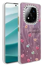 Newface Xiaomi Redmi Note 14 Pro 4G Kılıf Blade Aynalı Desenli Kapak - Desen 8