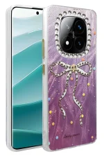 Newface Xiaomi Redmi Note 14 Pro 5G Kılıf Blade Aynalı Desenli Kapak - Desen 1